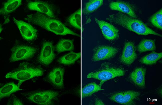 YTHDF2 Antibody in Immunocytochemistry (ICC/IF)