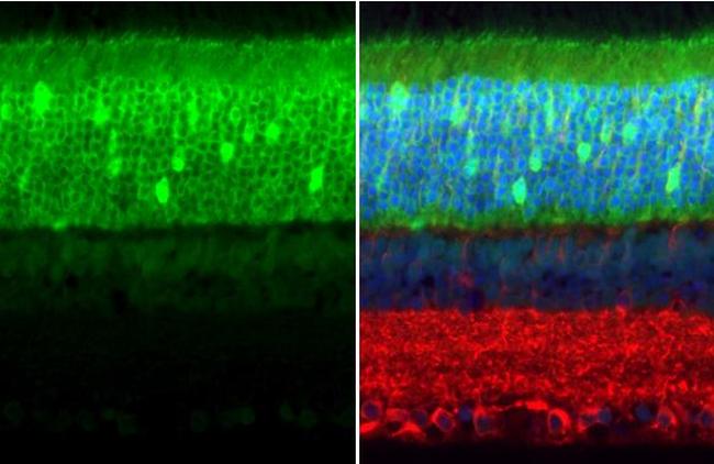 PDE6D Antibody in Immunohistochemistry (Paraffin) (IHC (P))