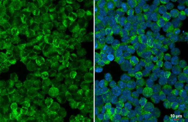 STAR Antibody in Immunocytochemistry (ICC/IF)