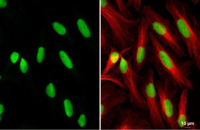 PARP1 Antibody in Immunocytochemistry (ICC/IF)