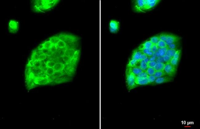 Fibrinogen gamma Antibody in Immunocytochemistry (ICC/IF)