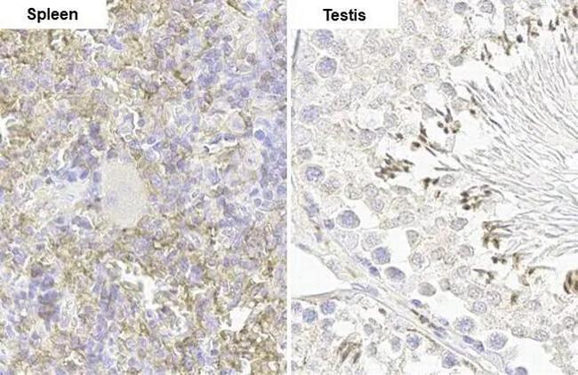 FCER1G Antibody in Immunohistochemistry (Paraffin) (IHC (P))