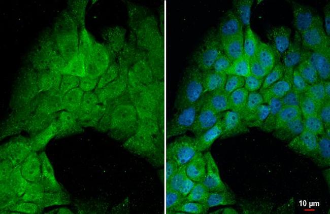 PP2A alpha Antibody in Immunocytochemistry (ICC/IF)