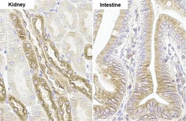 SHB Antibody in Immunohistochemistry (Paraffin) (IHC (P))