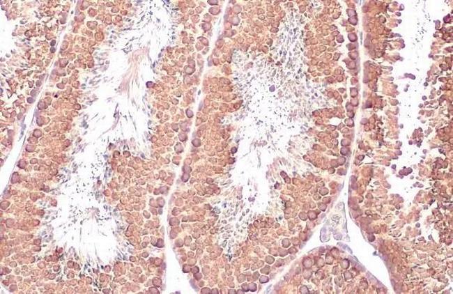 DDX4 Antibody in Immunohistochemistry (Paraffin) (IHC (P))