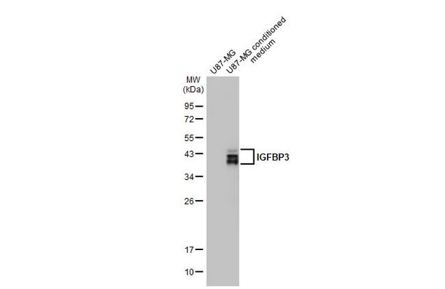 IGFBP3 Antibody in Western Blot (WB)