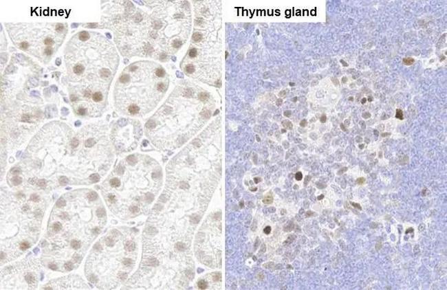 PARP3 Antibody in Immunohistochemistry (Paraffin) (IHC (P))