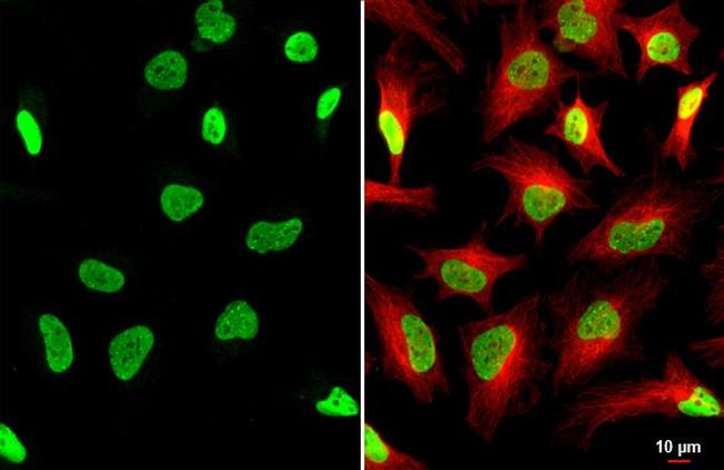 TRIM28 Antibody in Immunocytochemistry (ICC/IF)