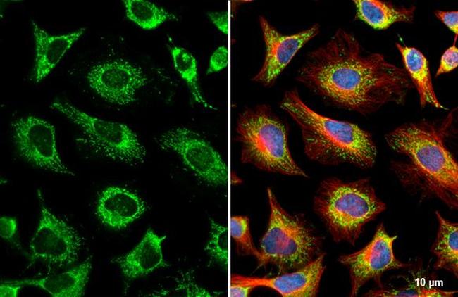 GRK2 Antibody in Immunocytochemistry (ICC/IF)