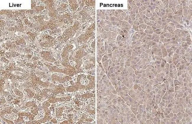 ADAM17 Antibody in Immunohistochemistry (Paraffin) (IHC (P))