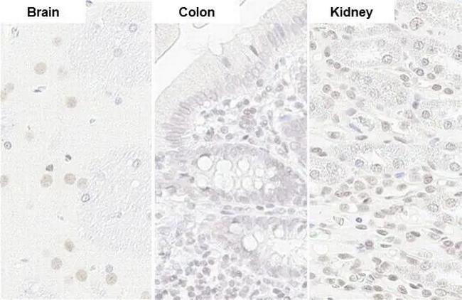 U2AF2 Antibody in Immunohistochemistry (Paraffin) (IHC (P))