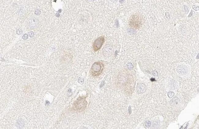 PIK3C2A Antibody in Immunohistochemistry (Paraffin) (IHC (P))