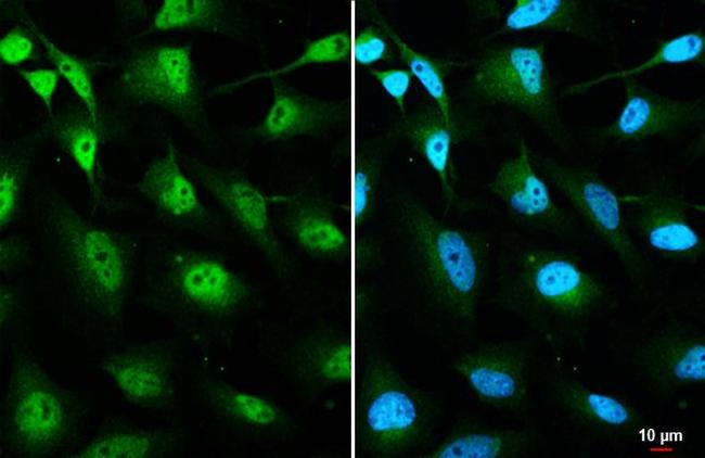 OGT Antibody in Immunocytochemistry (ICC/IF)