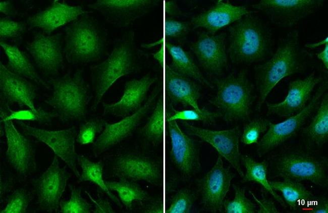 OGT Antibody in Immunocytochemistry (ICC/IF)