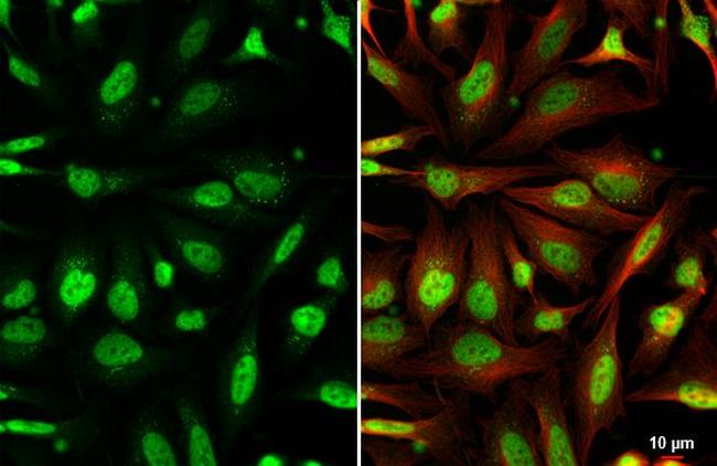 AF9 Antibody in Immunocytochemistry (ICC/IF)