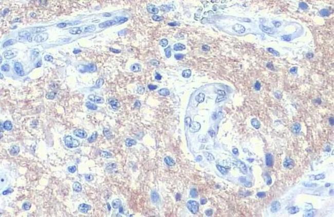 SNAP91 Antibody in Immunohistochemistry (Paraffin) (IHC (P))