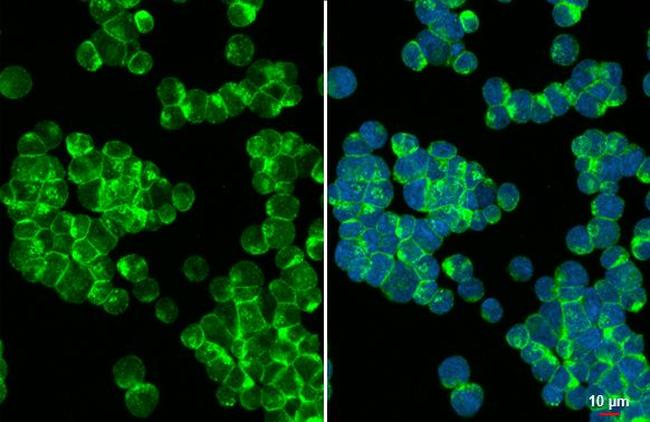 CD81 Antibody in Immunocytochemistry (ICC/IF)