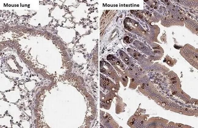 HCK Antibody in Immunohistochemistry (Paraffin) (IHC (P))