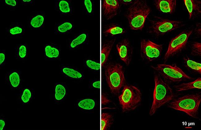 hnRNP A2B1 Antibody in Immunocytochemistry (ICC/IF)