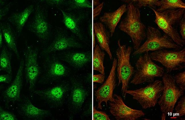 KIAA1429 Antibody in Immunocytochemistry (ICC/IF)