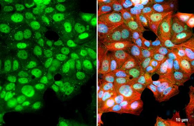 KDM6A Antibody in Immunocytochemistry (ICC/IF)