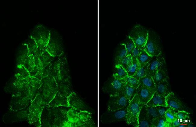 beta Catenin Antibody in Immunocytochemistry (ICC/IF)