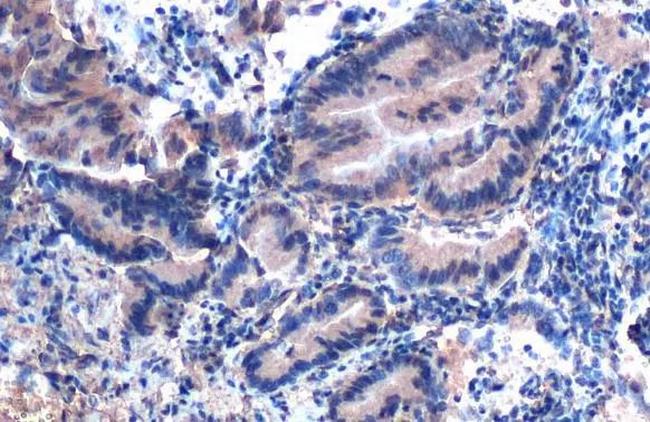 eIF6 Antibody in Immunohistochemistry (Paraffin) (IHC (P))