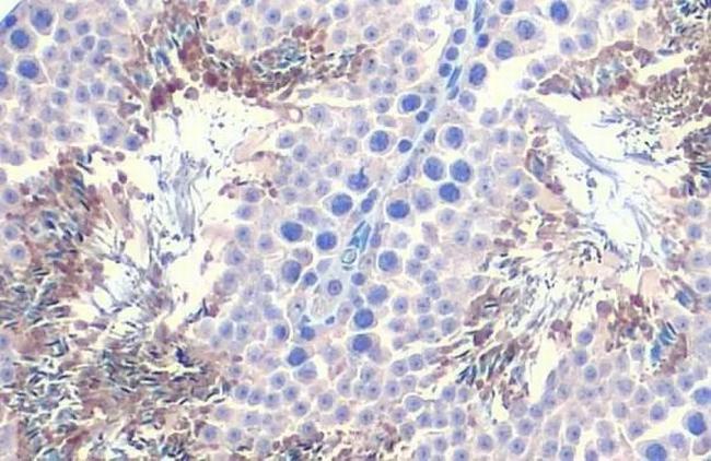 PGK1/PGK2 Antibody in Immunohistochemistry (Paraffin) (IHC (P))