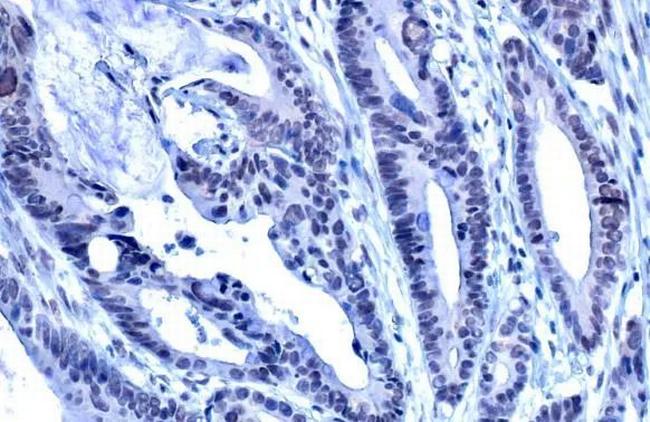 ADAR1 Antibody in Immunohistochemistry (Paraffin) (IHC (P))