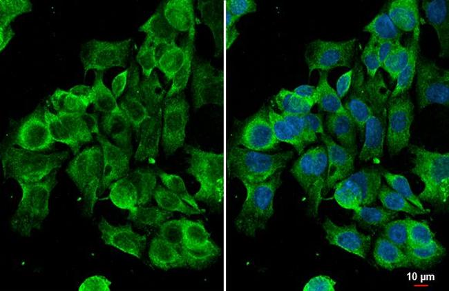 GRP78 Antibody in Immunocytochemistry (ICC/IF)