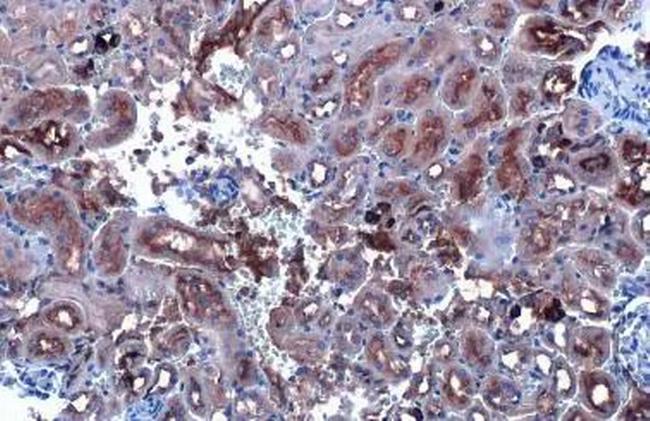 CYP27A1 Antibody in Immunohistochemistry (Paraffin) (IHC (P))