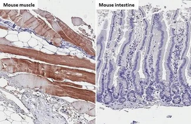 TRIM72 Antibody in Immunohistochemistry (Paraffin) (IHC (P))