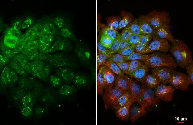 IL-18 Antibody in Immunocytochemistry (ICC/IF)