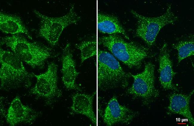 YTHDC2 Antibody in Immunocytochemistry (ICC/IF)