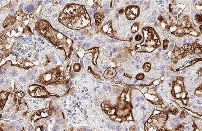 RAI3 Antibody in Immunohistochemistry (Paraffin) (IHC (P))