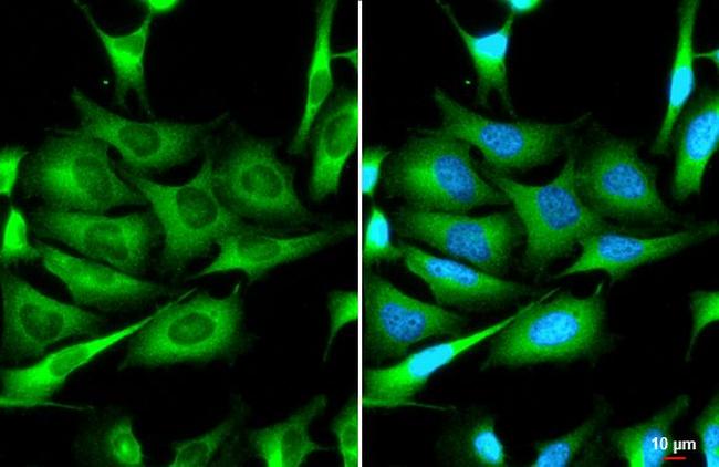 ZC3HAV1 Antibody in Immunocytochemistry (ICC/IF)