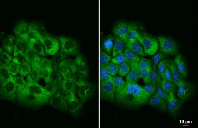 Ataxin 2 Antibody in Immunocytochemistry (ICC/IF)