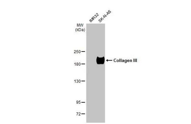 Collagen III Antibody in Western Blot (WB)