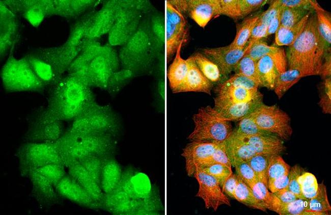 Ataxin 3 Antibody in Immunocytochemistry (ICC/IF)