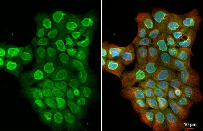 UNC84A Antibody in Immunocytochemistry (ICC/IF)