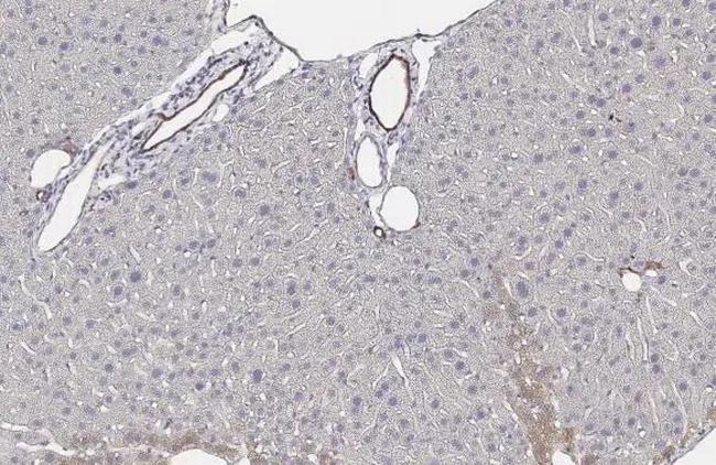 IGF1R (CD221) Antibody in Immunohistochemistry (Paraffin) (IHC (P))