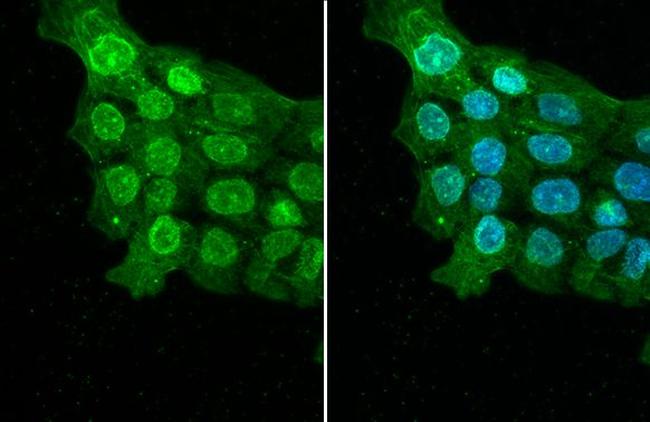 ELAVL2 Antibody in Immunocytochemistry (ICC/IF)