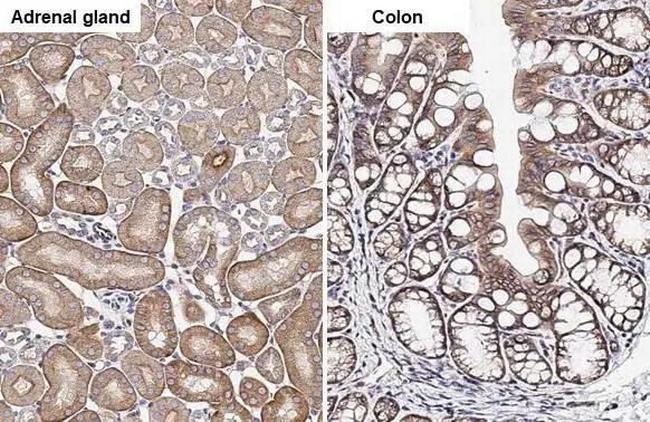 SIGIRR Antibody in Immunohistochemistry (Paraffin) (IHC (P))