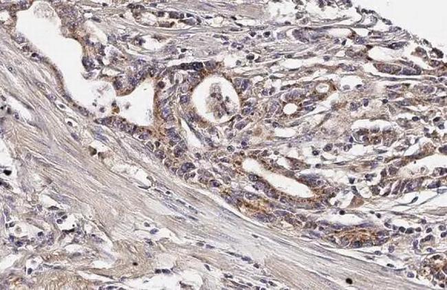 TFAM Antibody in Immunohistochemistry (Paraffin) (IHC (P))