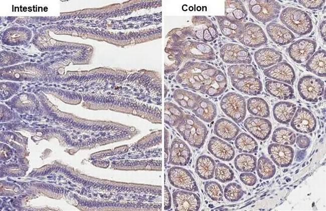 Desmoglein 2 Antibody in Immunohistochemistry (Paraffin) (IHC (P))