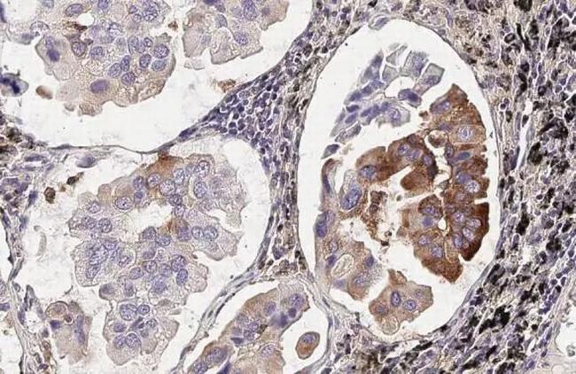 MX1 Antibody in Immunohistochemistry (Paraffin) (IHC (P))