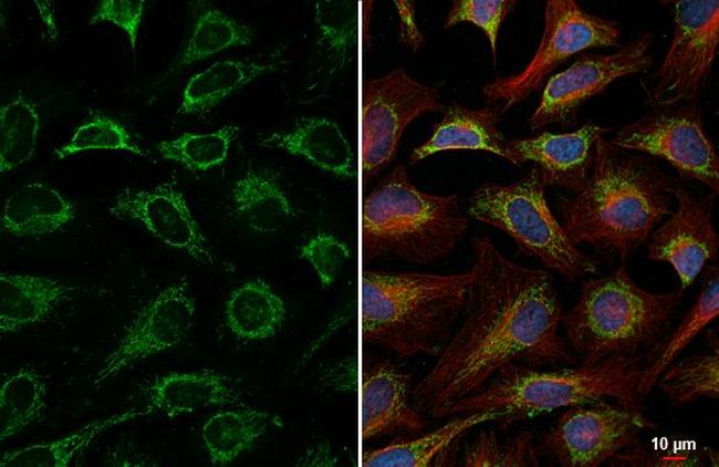 LRP130 Antibody in Immunocytochemistry (ICC/IF)