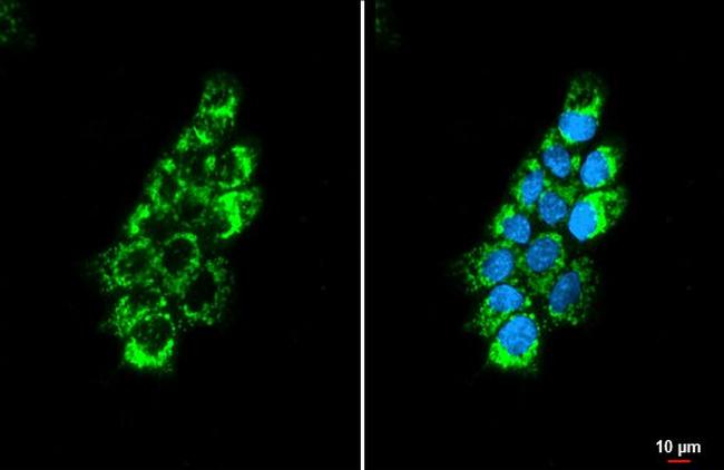 OAT Antibody in Immunocytochemistry (ICC/IF)