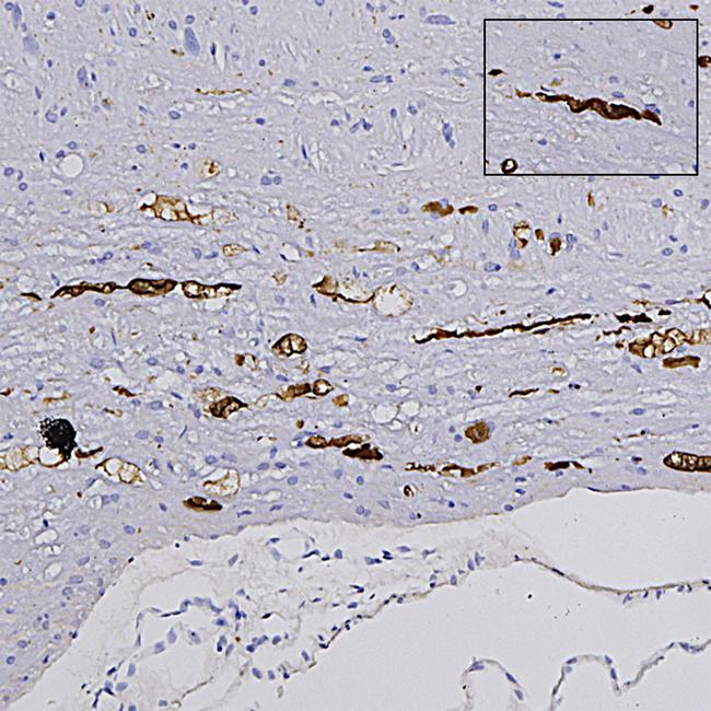 NEFL Antibody in Immunohistochemistry (Paraffin) (IHC (P))