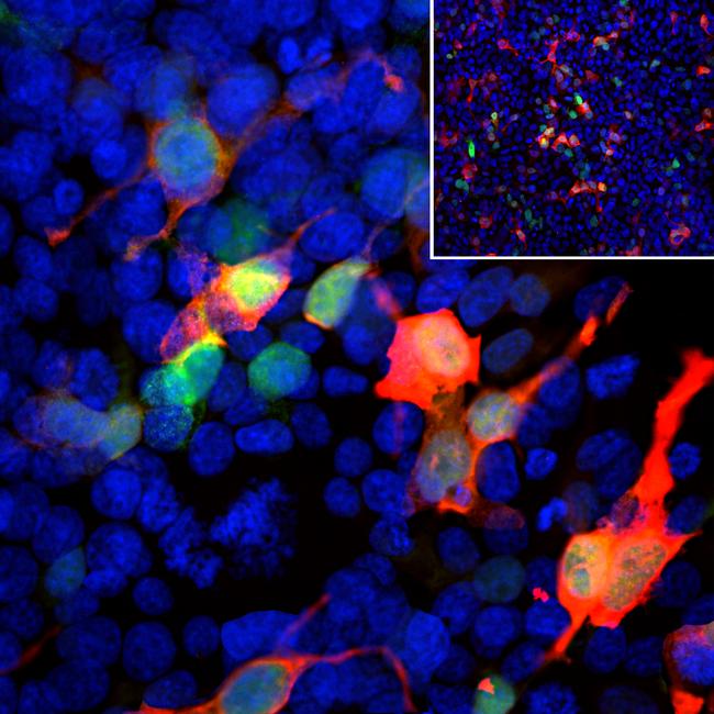 GFP Antibody in Immunocytochemistry (ICC/IF)